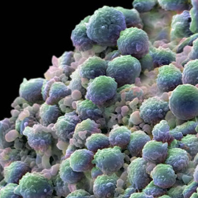 Foto: wellcome.ac.uk