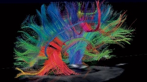  Tehnologia diffusion tensor imaging fotografiază creierul şi măsoară mişcările aleatorii ale apei din interiorul lui