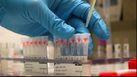 Greseala in diagnosticarea cancerului. Poate conduce la un tratament greÈ™it