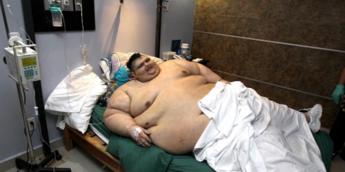Cel mai greu om din lume pierde în greutate)