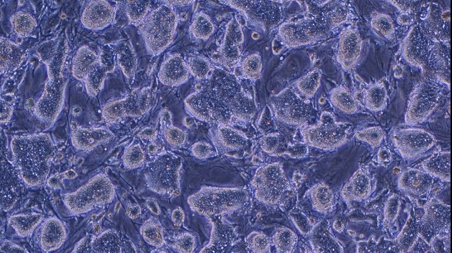 celule stem