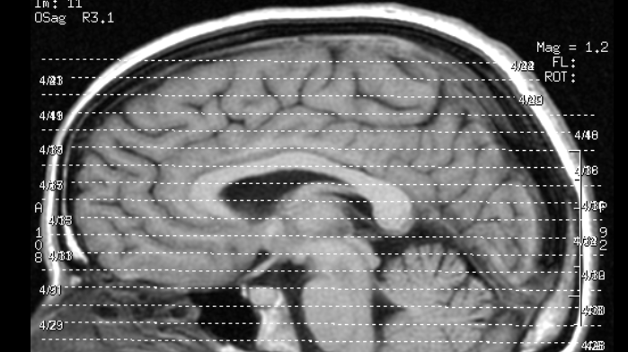 fMRI-ul nu a putut să-l salveze pe Brian Dugan de la pedeapsa capitală