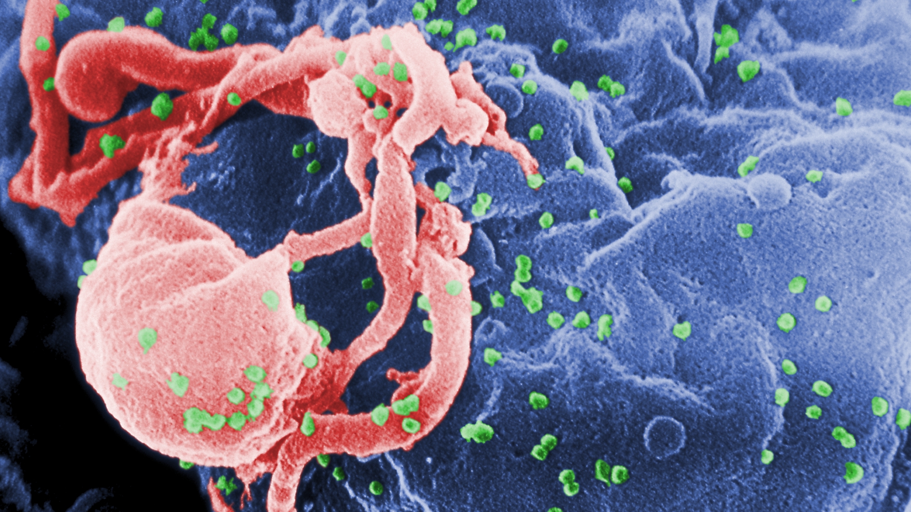 Ilustraţie a virusului HIV