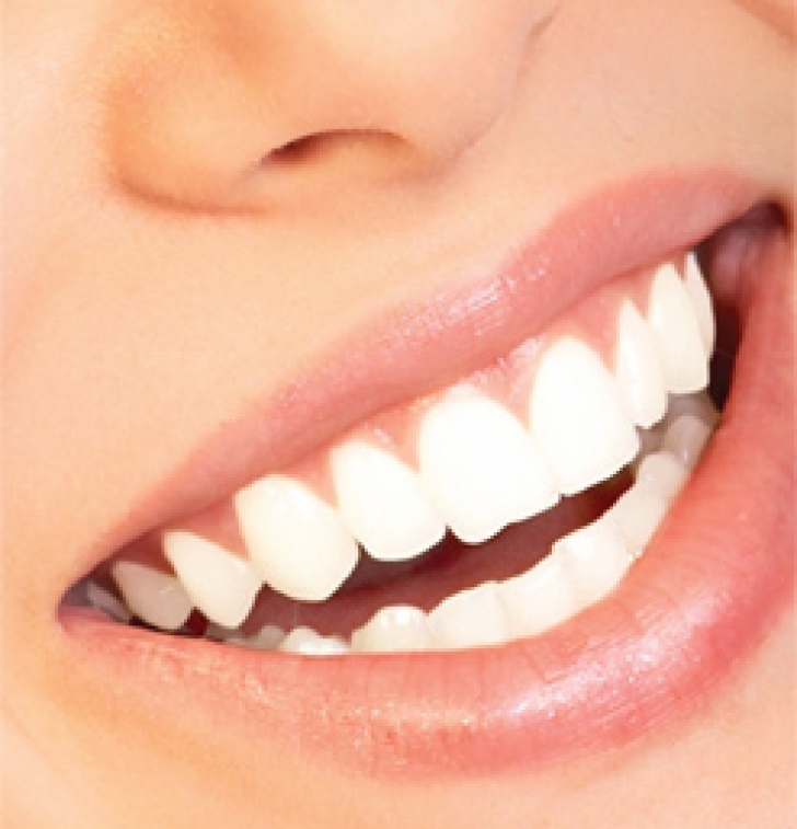 Cel mai important lucru pe care trebuie să îl faci pentru a avea dinţi albi şi sănătoşi