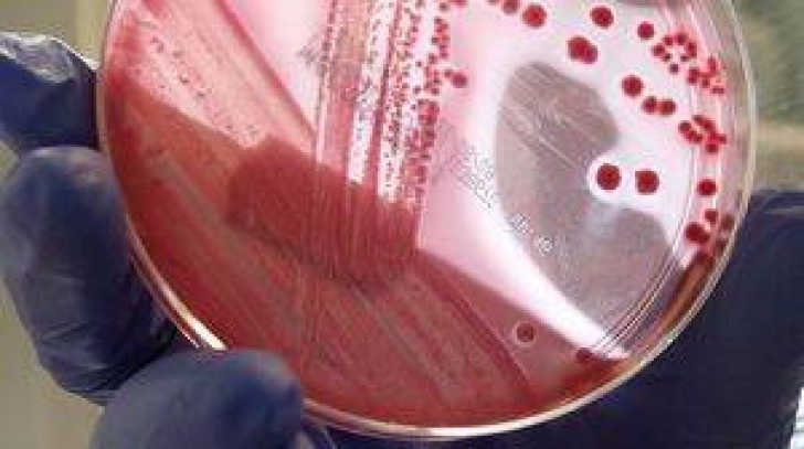 Mai multe persoane infectate cu E.coli au murit