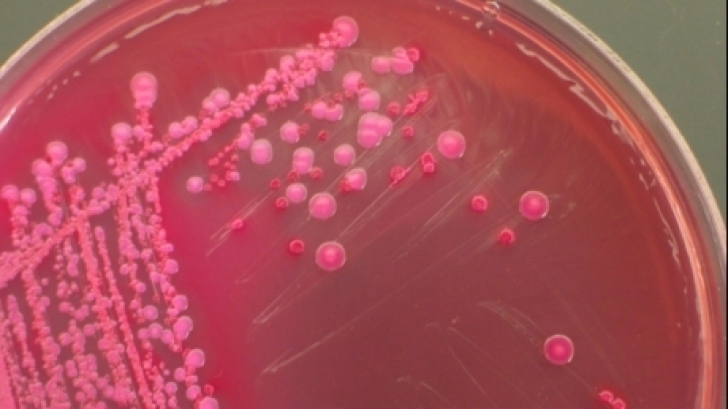 Epidemia de E.coli este gravă