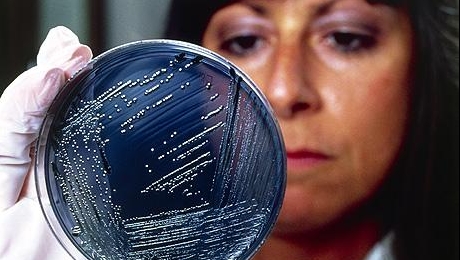 O nouă tulpină de salmonella rezistentă la antibiotice ameninţă să se răspândească în lume
