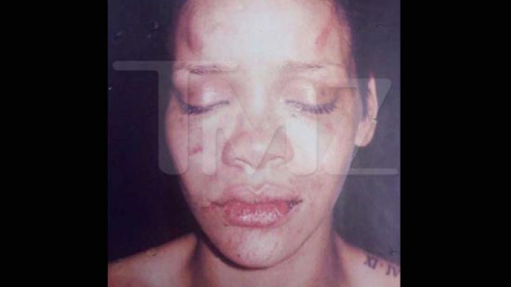 Rihanna, bătută de Chris Brown. Foto: TMZ