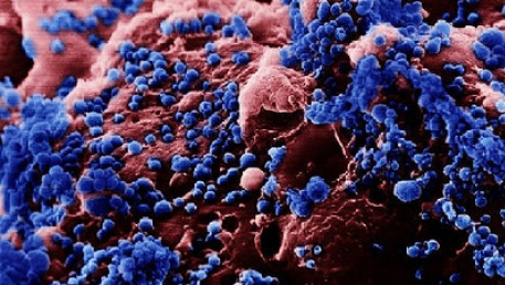 Un virus periculos, care se transmite de la animale la oameni, stârnește îngrijorare “enormă” la OMS