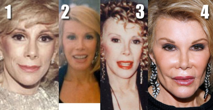 Joan Rivers, înainte şi după operaţiile estetice