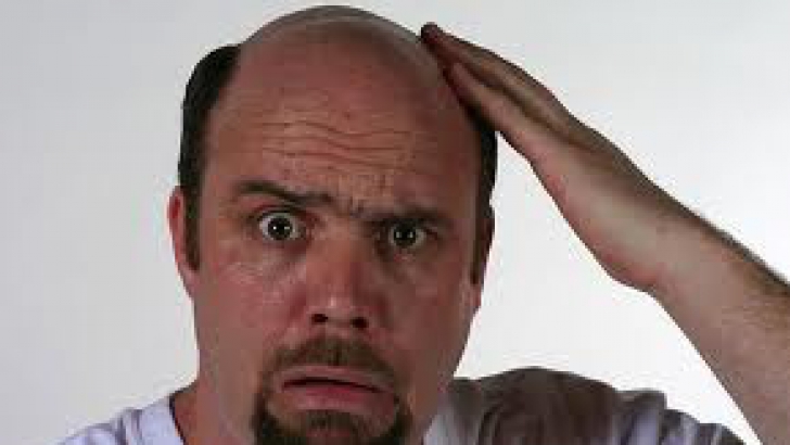 Căderea părului, un subiect sensibil bărbaţi. Câţi vor să apeleze la proceduri chirurgicale