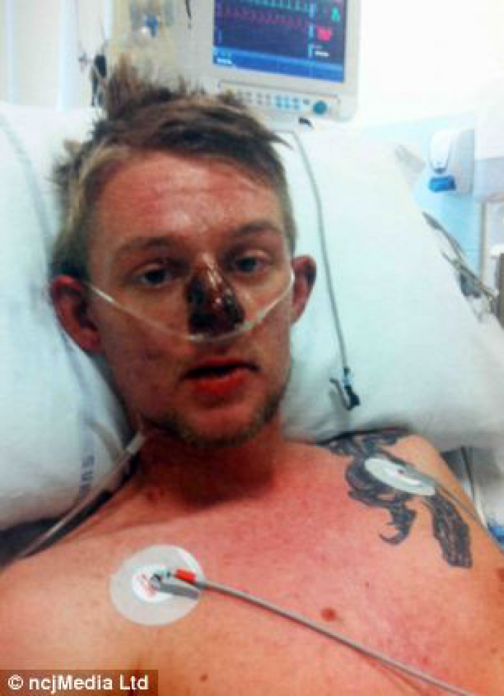 Un bărbat de 28 de ani din Washington a stat nouă zile în comă din cauza unui medicament pentru dureri.