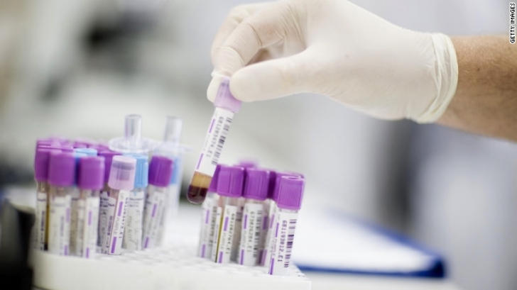 Un nou test de depistare a cancerului de col uterin, lansat pe piaţă