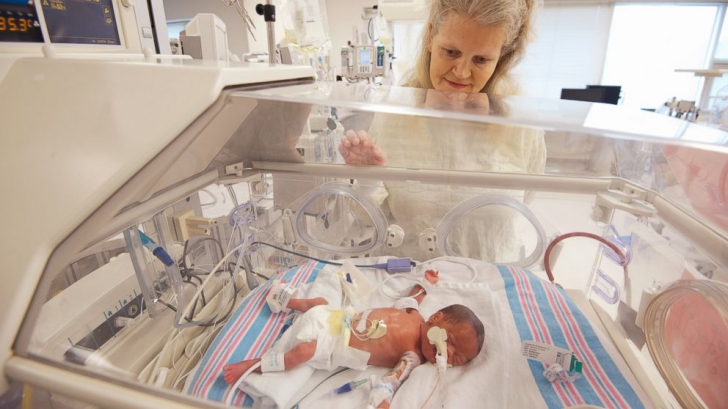 O femeie din Mississippi, SUA, care trebuia să nască tripleţi identici a avut o surpriză urişă pe masa de operaţie