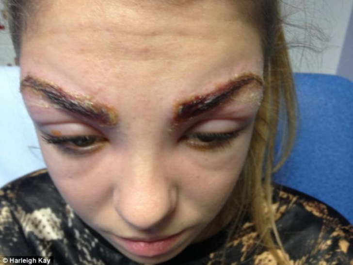 Fata de 17 ani, desfigurată după ce şi-a tatuat sprâncenele