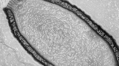 DESCOPERIREA care te va cutremura! Omenirea, &icirc;n pericol din cauza unui tip de virus uriaş