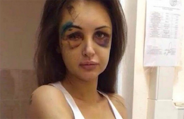 Aleksandra Sereda a fost batuta brutal de iubitul ei