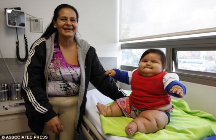 Un băieţel de 8 luni din Columbia cântăreşte 20 de kg, greutatea recomandată pentru un copil de 6 ani