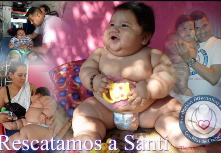 Un băieţel de 8 luni din Columbia cântăreşte 20 de kg, greutatea recomandată pentru un copil de 6 ani