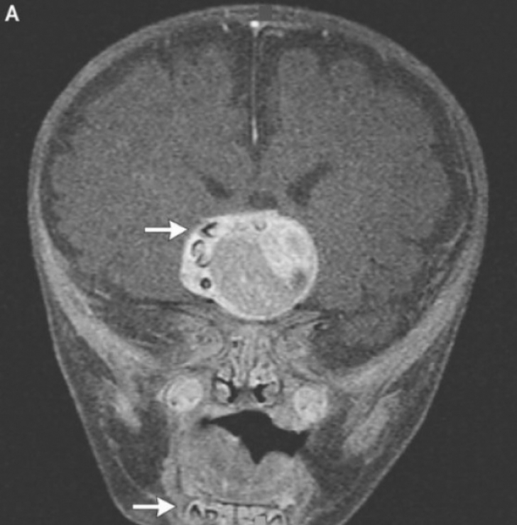 Medicii, INGROZITI cand au vazut radiografia unui baietel in varsta de patru luni 