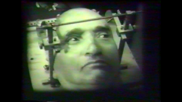 Imagini spectaculoase, în premieră, din timpul primei operații pe creier de acum 40 de ani.