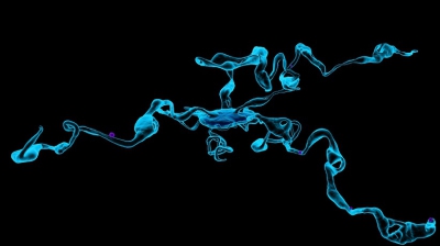 CELULELE CARE VINDECĂ CIROZA. Descoperire revoluţionară a cercetătorilor rom&acirc;ni