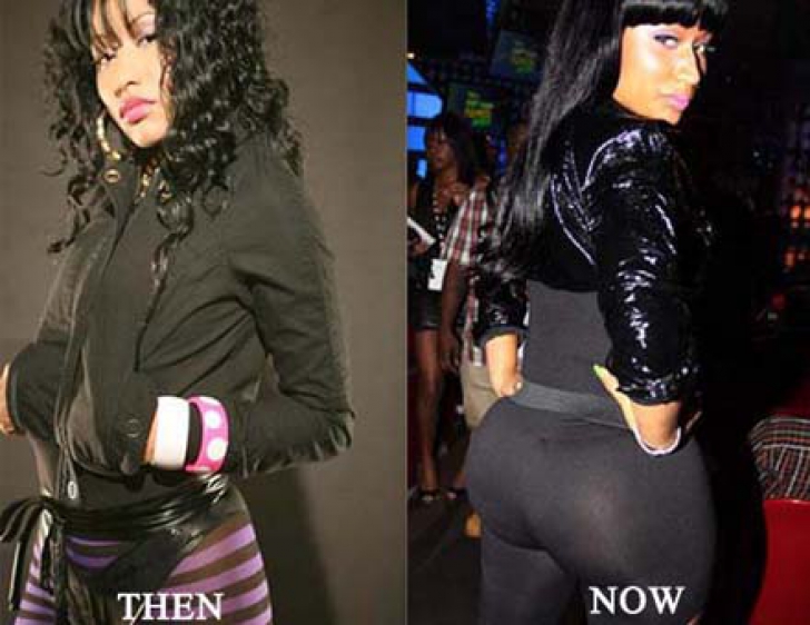 Ники минаж до пластики. Nicki Minaj before butt Implants. Ники Минаж до операции ягодиц. Пластическая операция на попу. Перебор с пластикой ягодиц.