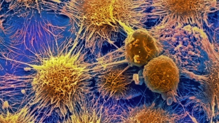 Celule canceroase