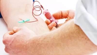 Hepatita C a făcut anul trecut 1200 de victime. "Este nevoie de o strategie naţională"