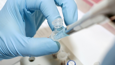 REVOLUŢIONAR: Celule suşă, folosite pentru RECONSTRUCŢIA CORNEEI umane