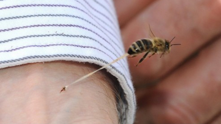 A prins o albină şi a lăsat-o să îl înţepe. Motivul este uimitor. Ai încerca aşa ceva?