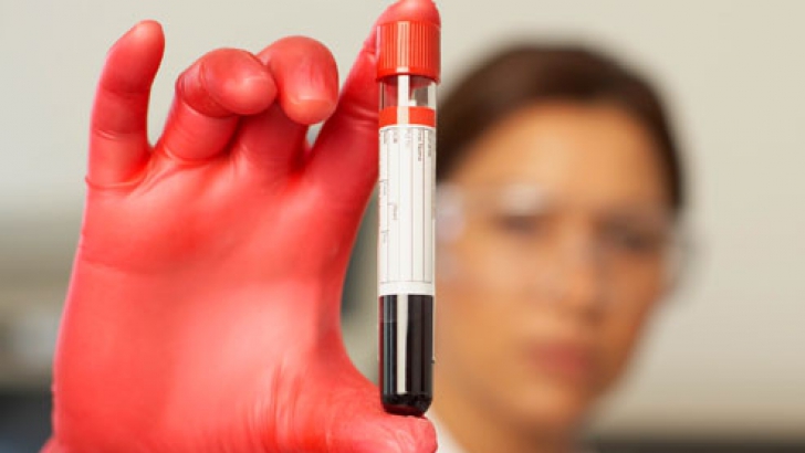 Un simplu test sangvin ar putea prezice RISCUL DE SINUCIDERE