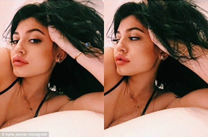 Kylie Jenner a exagerat: cât de mult şi-a mărit buzele cu acid hialuronic