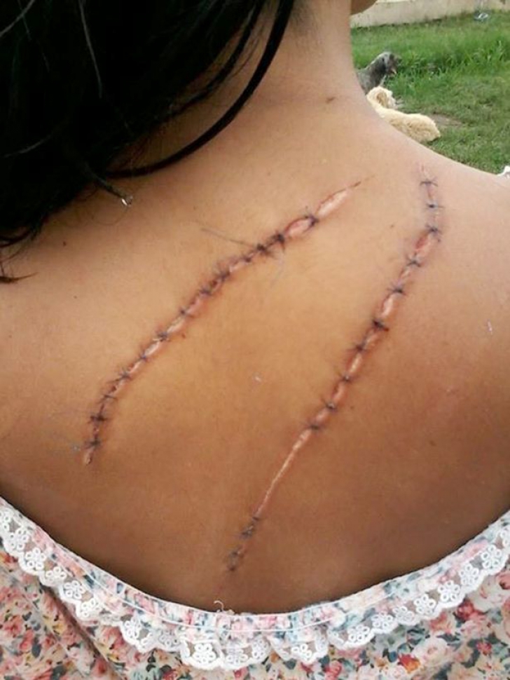 Julia Alvarez, 15 ani, mutilată pentru că era prea frumoasă