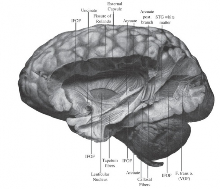 INCREDIBIL - O nouă regiune din creier, redescoperită după sute de ani 