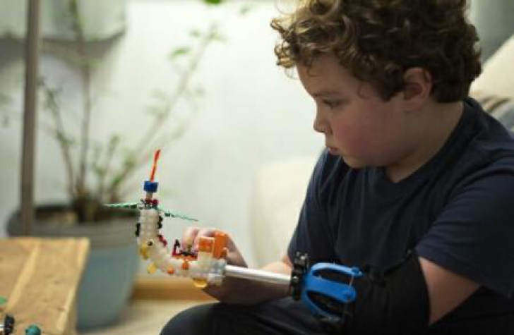 EMOȚIONANT. Un băiețel de nouă ani, fără un braț, și-a construit o proteză din Lego