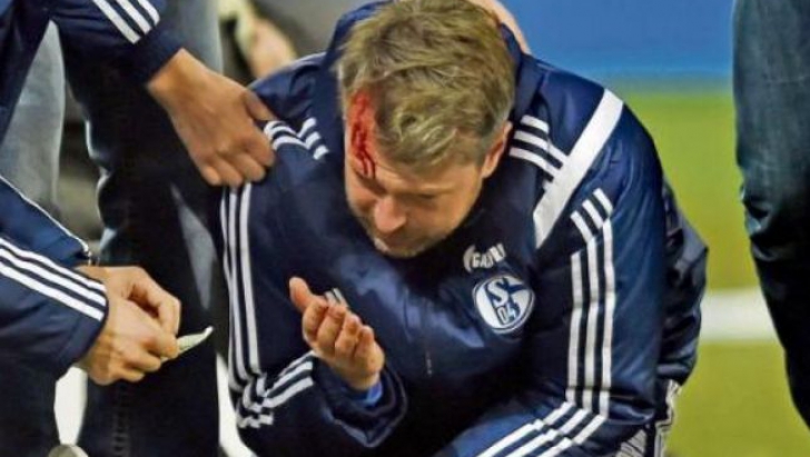 Scene HORROR în fotbalul german: un suporter i-a spart capul cu o brichetă unui antrenor 
