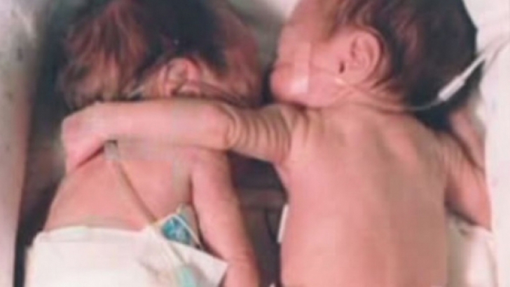 O fetiţă nascută prematur era pe MOARTE. A fost pusă langa sora geamană. Ce a urmat e cutremurător 