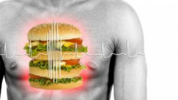 Șase factori ai infarctului miocardic