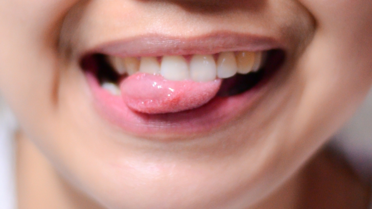 Ce îţi transmite limba despre sănătatea ta
