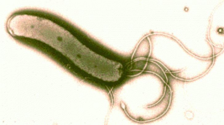 Leguma care omoara bacteria helicobacter pilori, cea care cauzeaza ulcerele