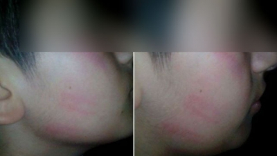 Fotografia copilului bătut de profesor, la şcoală, &icirc;n timpul pauzei mari