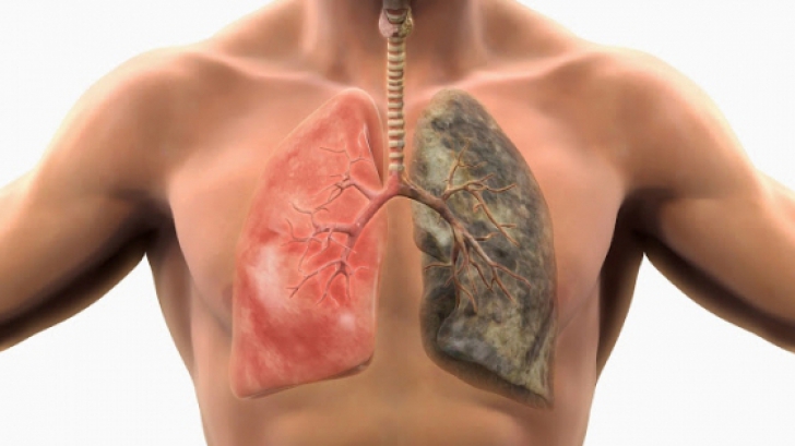 Fumezi? Aceasta este substanța toxică care râmâne în plămânii tăi 40 de ani