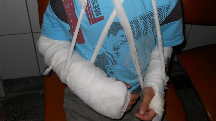 Incident şocant, la Cluj: după ora de sport, un elev de clasa a III-a are ambele mâini fracturate