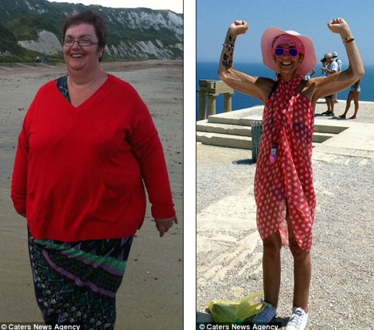 Era obeză şi a ajuns anorexică după ce a slăbit 127 de kilograme! Cum arată acum