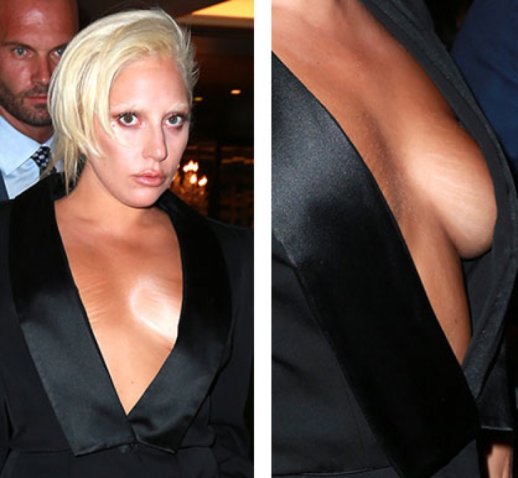 Lady Gaga e plină de vergeturi! Cum s-a afișat fără nicio rușine