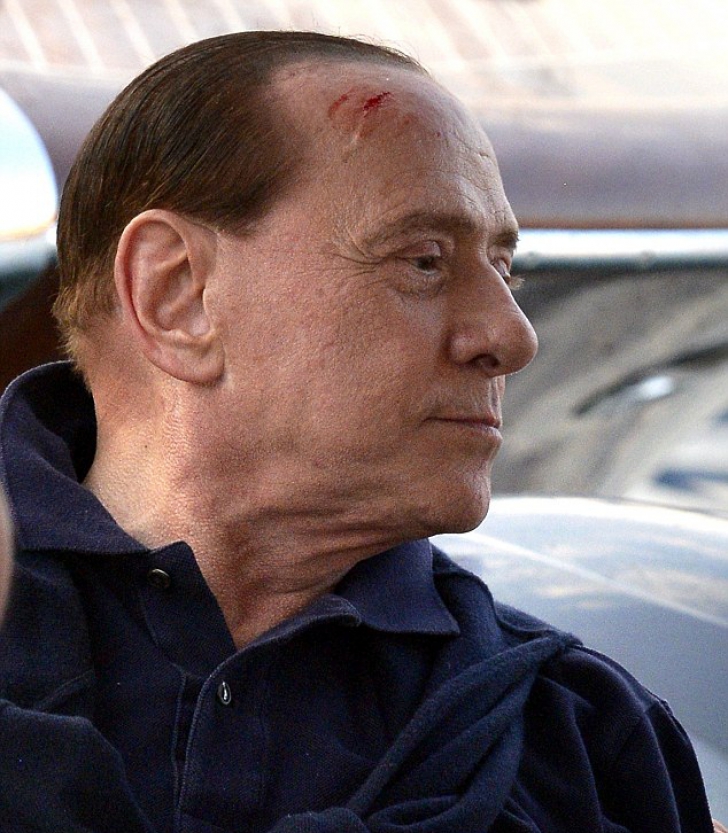 Berlusconi, rănit la cap pe Coasta de Azur. Care este starea de sănătate a fostului premier italian