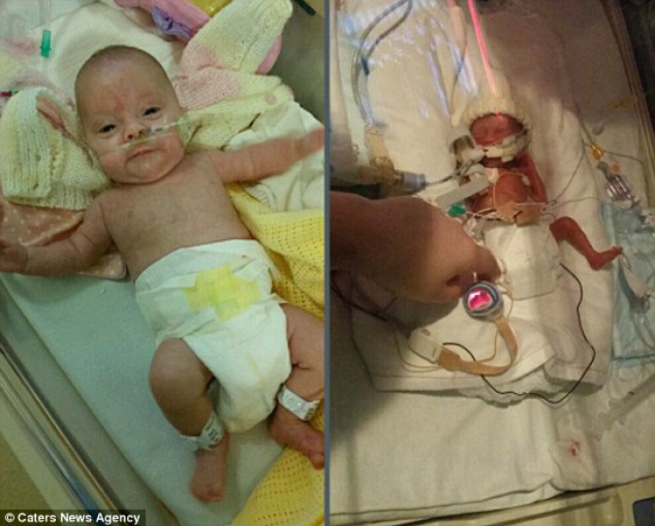 Fiica lor s-a născut prematur şi le-au spus că va muri în 21 de zile. Prima fotografie, sfâşietoare