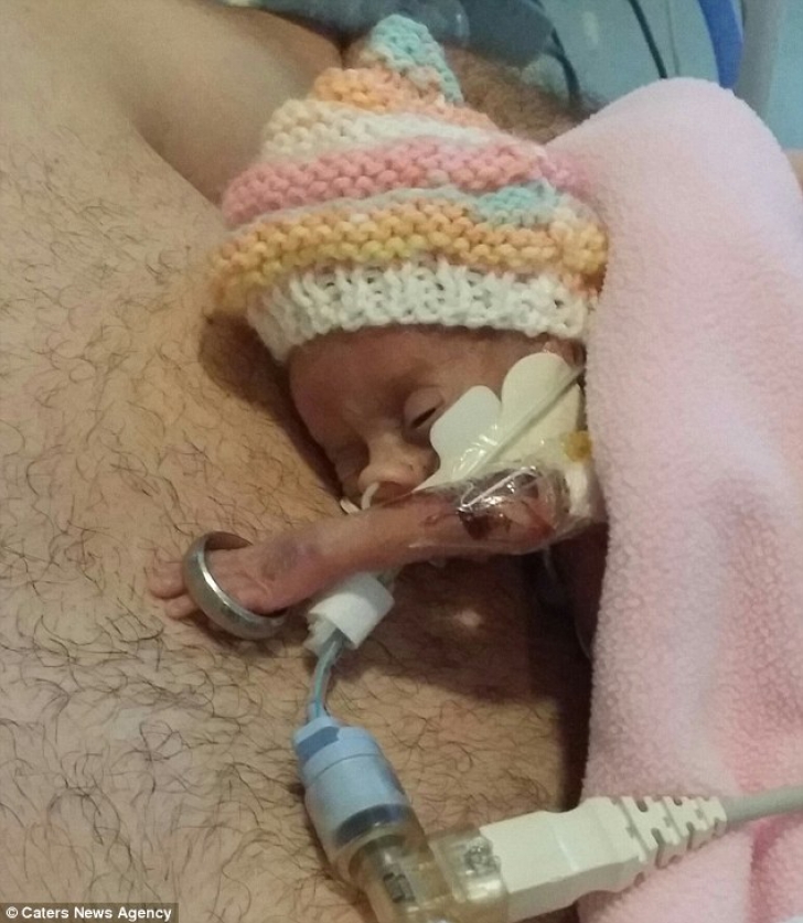 Fiica lor s-a născut prematur şi le-au spus că va muri în 21 de zile. Prima fotografie, sfâşietoare
