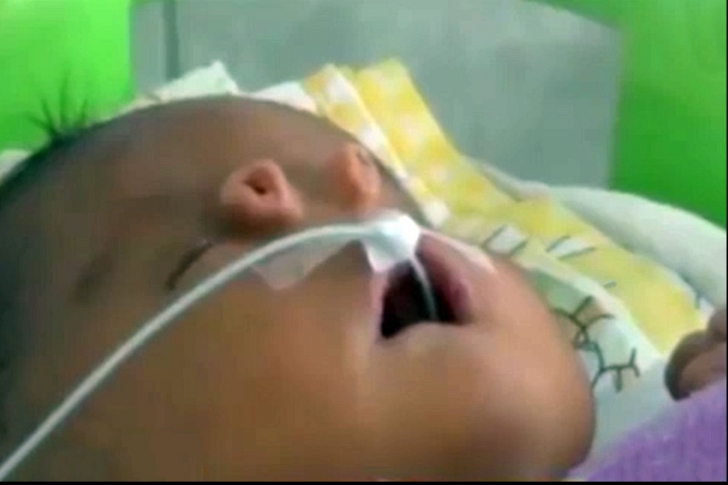 Cum arată bebelușul care s-a născut cu două nasuri? Medicii au rămas șocați